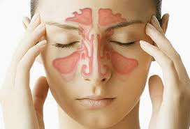 Why Do I Wake Up With A Stuffy Nose And Sinus Pressure? Video